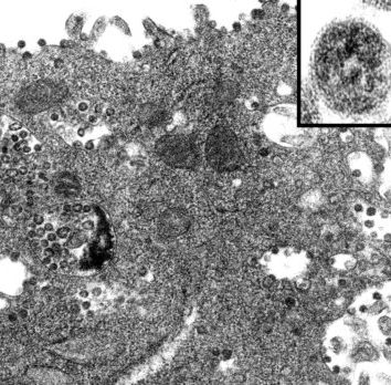 La profezia del vaiolo delle scimmie