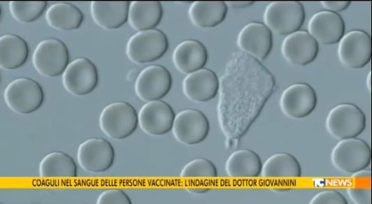 Coaguli nel sangue…