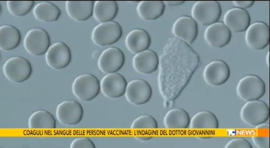 Coaguli nel sangue… article-post