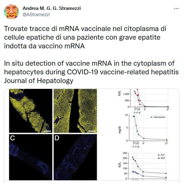L’mRNA vaccinale nel citoplasma di cellule epatiche article-post