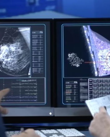 Lo screening alla mammella e Peter Gøtzsche