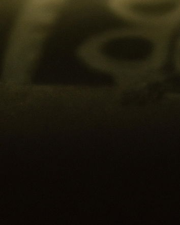 Il “report” in cui Pfizer ammette di aver raccolto segnalazioni