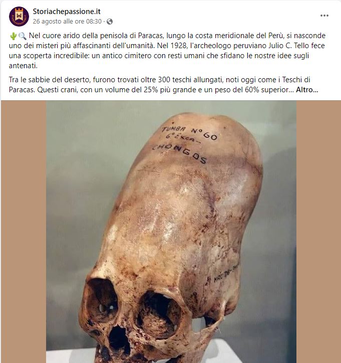 article-post