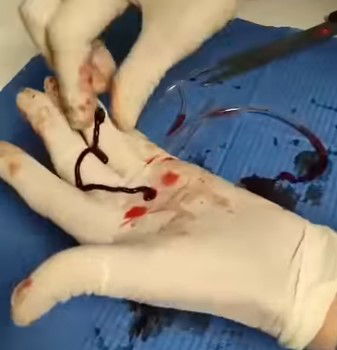 Il sangue dei vaccinati