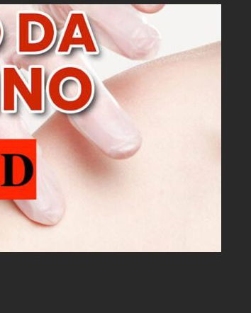 Quei “1000 Articoli Sottoposti a Peer Reviewed Sulle Lesioni da Vaccino“