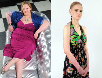 La ragazza che da obesa diventa anoressica