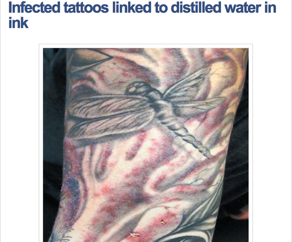 L’infezione da tatuaggio