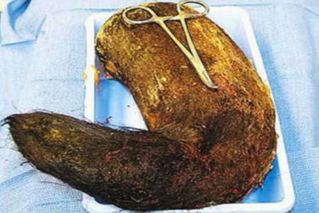 La ragazza con la palla di pelo da un chilo nella pancia article-post