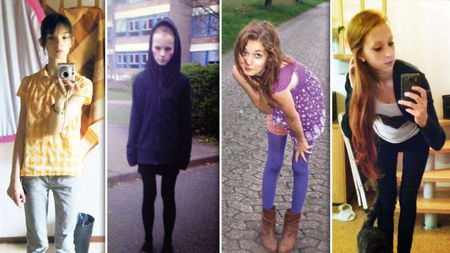 “Vi spiego cosa vuol dire essere anoressica” article-post