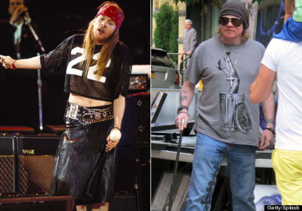 Axl Rose prima e dopo la cura dei vent’anni