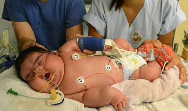 Il super neonato di sei chili