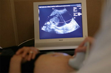 Abortire dopo i primi 90 giorni