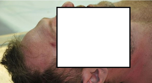 Le foto shock del cadavere di Riccardo  Magherini arrivano in Senato