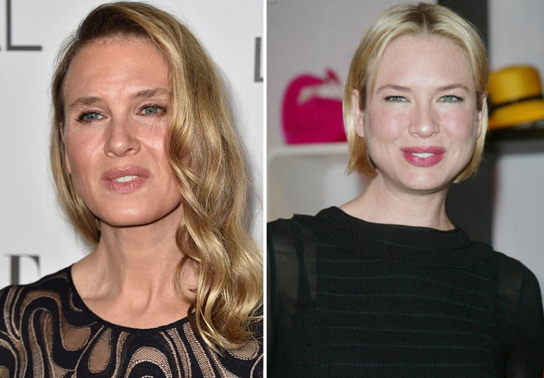 Renée Zellweger “cambia” faccia e risponde ai fan: «Sono felice così» article-post