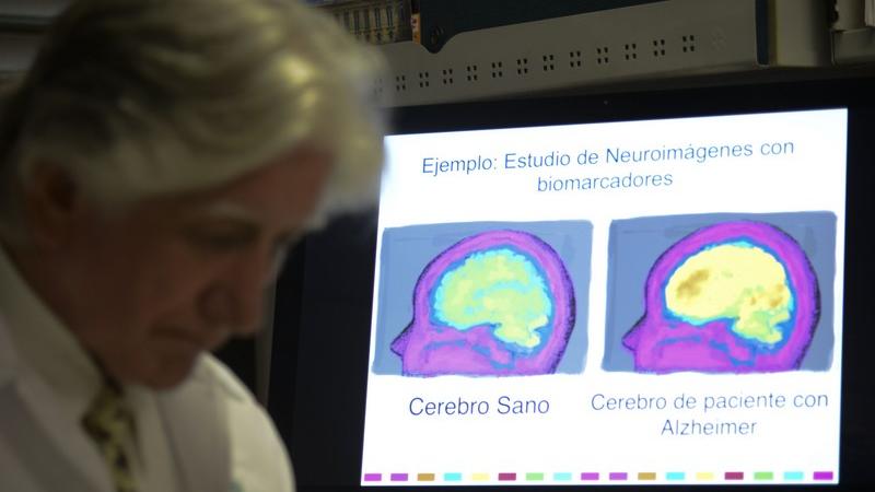 Cosa succede al cervello quando hai informazioni che non ti servono più?