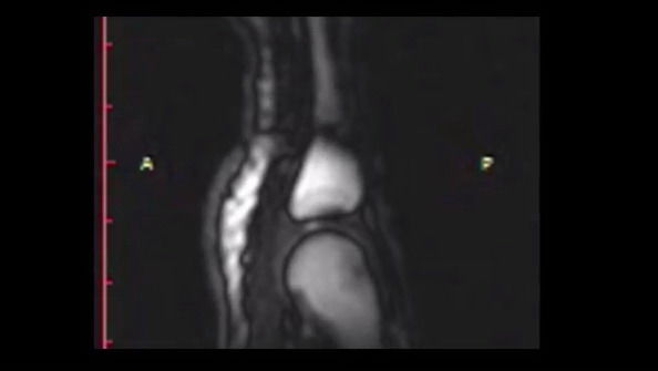 Perchè schioccano le dita