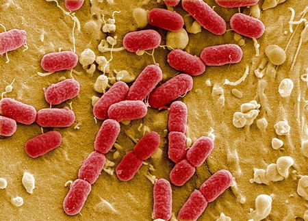 Oltre 500mila casi di infezioni per antibioticoresistenza: «L’arma migliore è lavarsi le mani» article-post