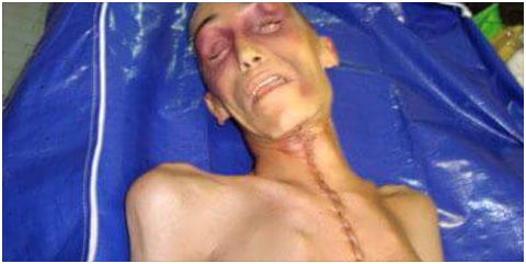 stefano cucchi
