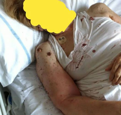 ospedale formiche
