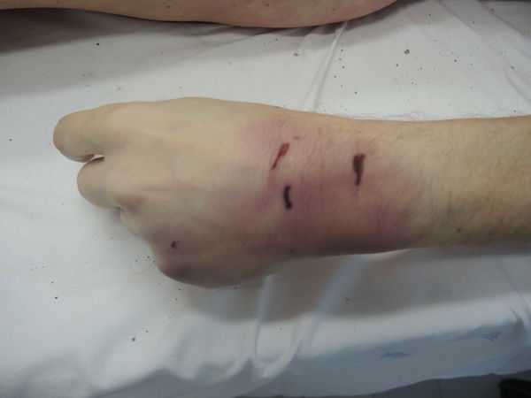 David Rossi, secondo voi questo è un suicidio? Tutti i dubbi sull’autopsia | GALLERY