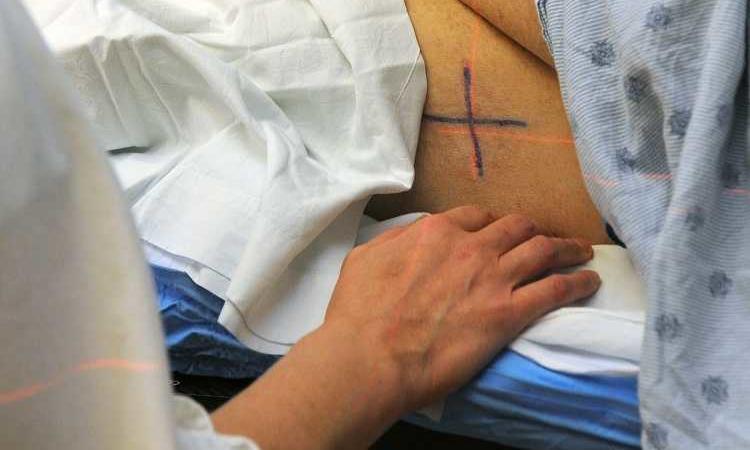 radioterapia stereotassica