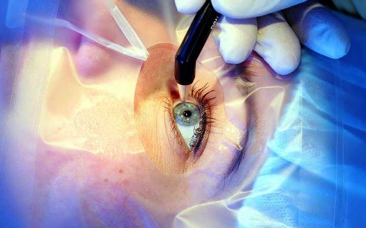 cornea