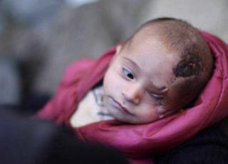 Ghouta orientale