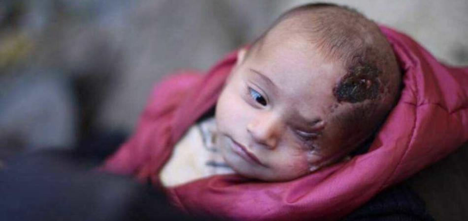 Ghouta orientale