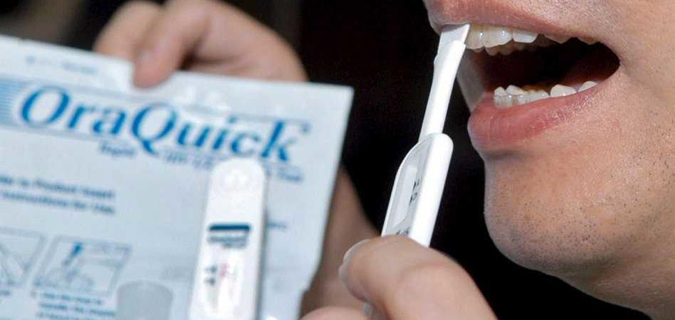 test hiv