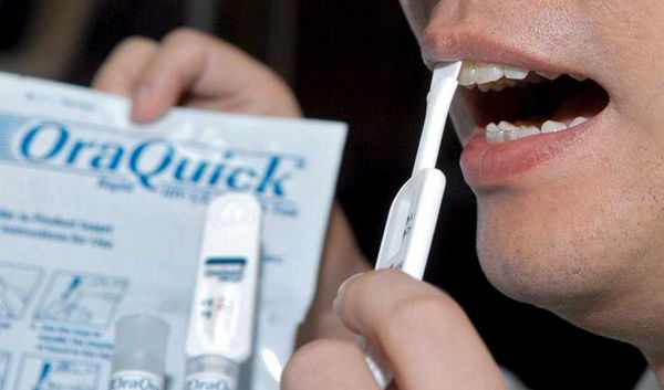 Come fare il test dell’Hiv