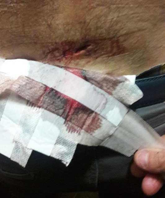 «Aggrediti a Genova da Casapound, accoltellato un nostro militante»