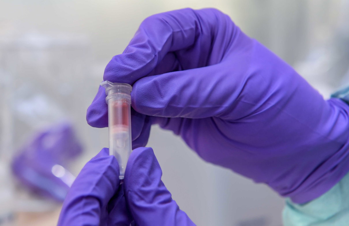 Cos’è «Disease X», la malattia perfetta (e ancora sconosciuta) che spaventa l’Oms article-post