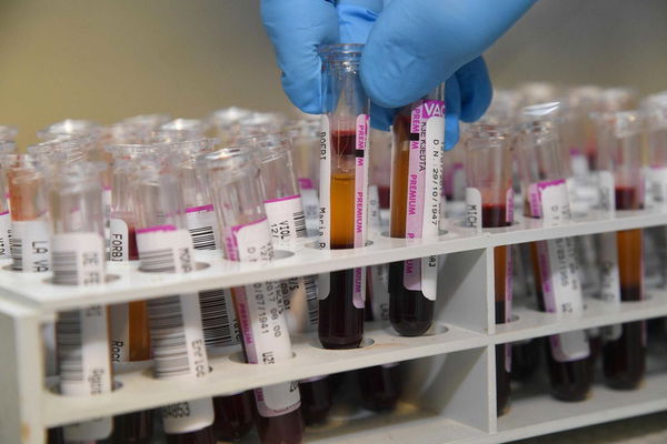 La speranza per l’immunità: gli anticorpi sviluppati dai pazienti guariti da Covid-19