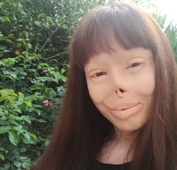 Valentina Pitzalis, sfregiata dall’ex, non c’entra con la morte del suo aguzzino