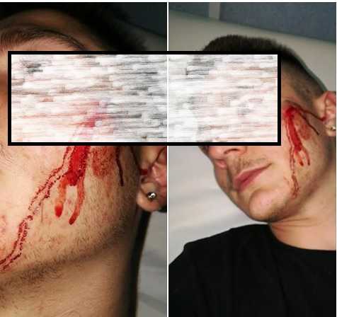 Napoli, 16enne picchiato a sangue e rapinato alla metro di Scampia