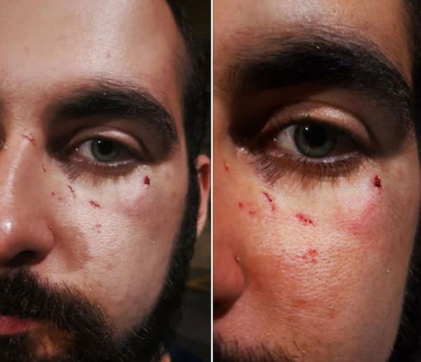 «Questo è quello che è successo a me e al mio ragazzo in Italia»