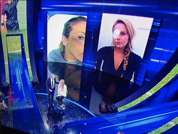 Elena Proietti, la donna arbitro aggredita in campo:«Io invalida al 67%, lui tornerà a giocare»