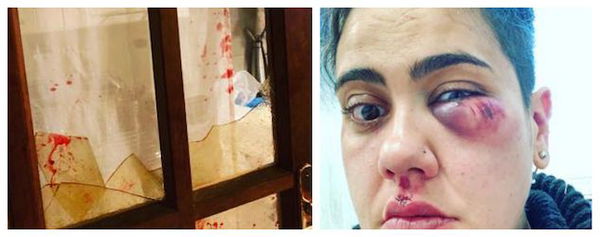 Bolsena, donna picchiata dagli amici che le gridavano «Muori lesbica»