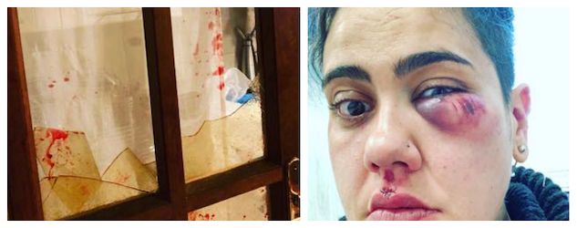 Bolsena, donna picchiata dagli amici che le gridavano «Muori lesbica» article-post