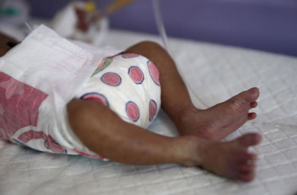 Bambina nasce cianotica, in arresto cardiaco e in ipossia. I genitori volevano per forza partorire in casa