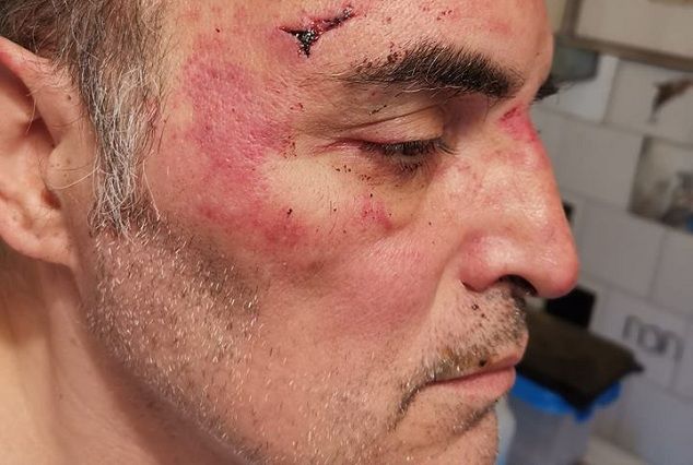 «Ti ammazziamo», a Torino 53enne picchiato a calci e pugni dai vicini perché gay article-post
