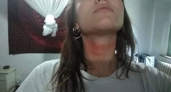 Firenze, denuncia di una manifestante: «Polizia mi ha detto: ‘ti infilo il manganello nell’ano’»