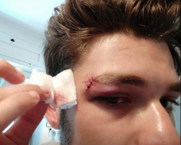 Il ragazzo picchiato per la maglietta del Cinema America: «Li denuncerò: alla violenza rispondo con la legalità»