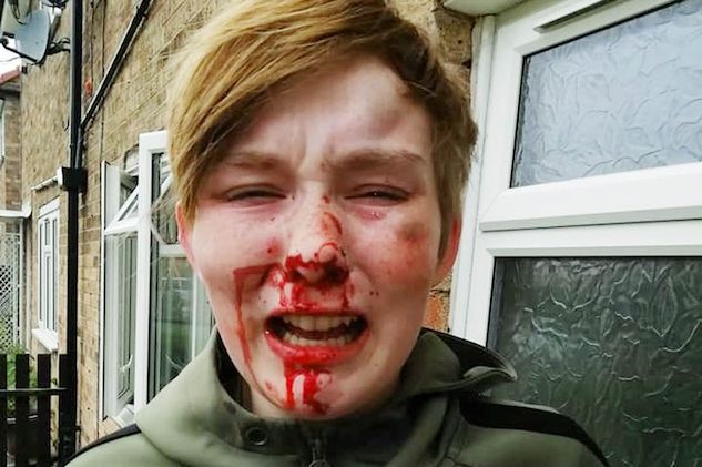 Uk, ancora aggressioni alimentate dall’omofobia: stavolta la vittima a solo 18 anni