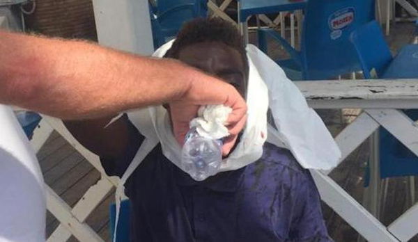 Anzio, «picchiato perché nero»: due giovani accusati di lesioni aggravate da discriminazione razziale