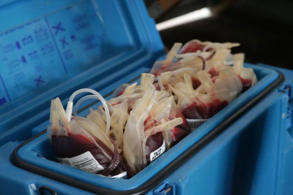 Muore a Monza per una trasfusione sbagliata: il sangue sbagliato per un caso di omonimia