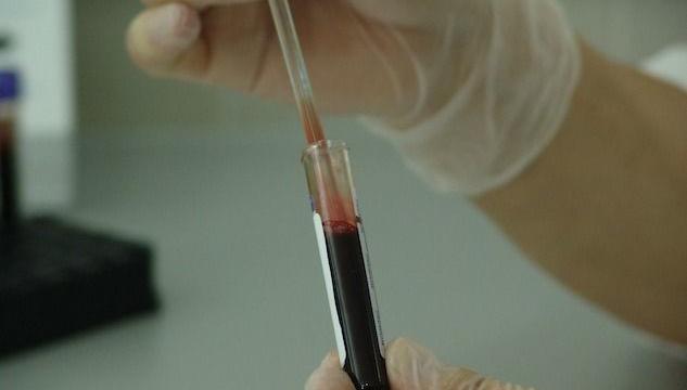 Arrestato il malato di Hiv di Messina che ha contagiato 4 donne: deceduta l'ex moglie
