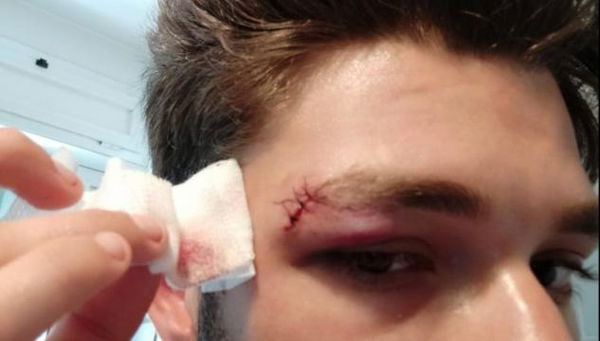 Tre arresti per l’aggressione ai danni dei ragazzi del Cinema America: tutti vicini a movimenti di estrema destra