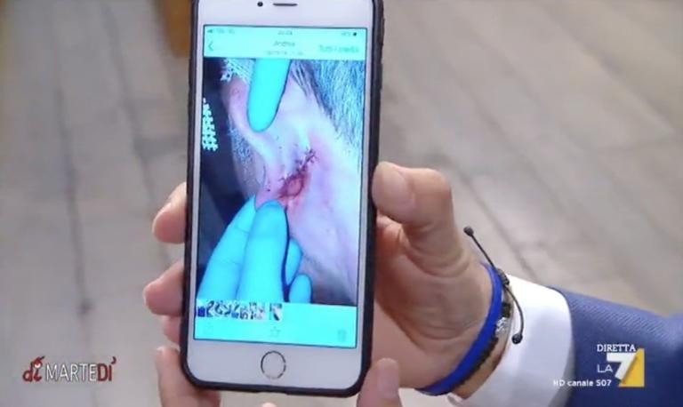 Salvini risponde sulla Russia e Savoini mostrando la foto dell’orecchio di un agente «morso da un nordafricano»