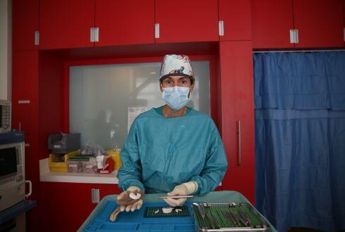 Ricostruito l’orecchio a un bambino grazie alla stampa 3D: è la prima volta in Italia